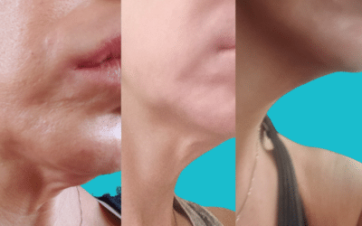 Neck Anti-aging For Lose Skin